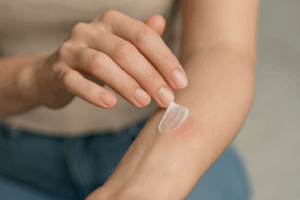 Jaki lek na zapalenie skóry przynosi ulgę przy swędzeniu?